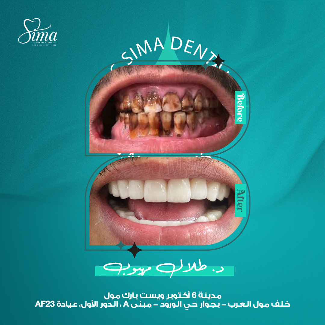 قبل وبعد — دكتور طلال مهيوب