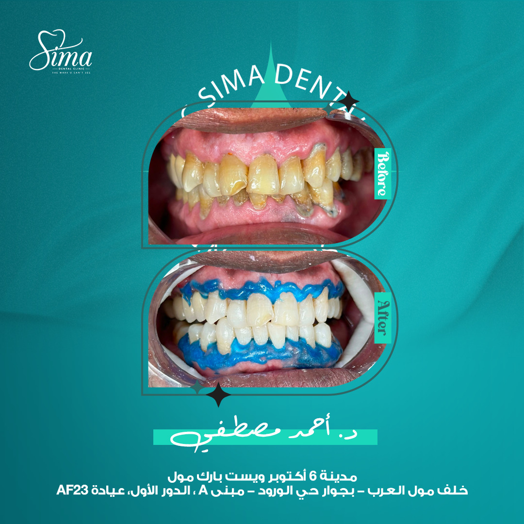 تنظيف وتجميل — دكتور أحمد مصطفى